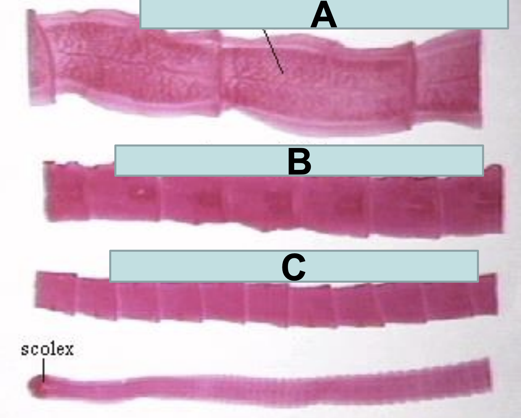 <p>Which set of proglottid are immature?</p>
