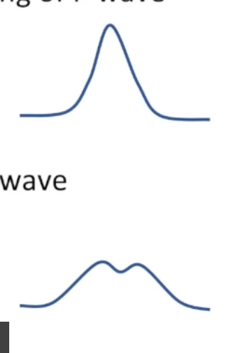 <ul><li><p>Right atrial abnormality: change to beginning of P wave</p><ul><li><p>Tall, peaked P wave</p></li><li><p>COPD</p></li><li><p>Pulmonary HTN</p></li><li><p>Congenital heart disease</p></li><li><p>RVHF</p></li></ul></li></ul><ul><li><p>Left atrial abnormality: change to end of P wave</p><ul><li><p>Wide, notched P wave</p></li><li><p>CAD</p></li><li><p>Cardiomyopathy</p></li><li><p>HTN</p></li><li><p>Valvular heart disease</p></li></ul></li></ul><p></p>