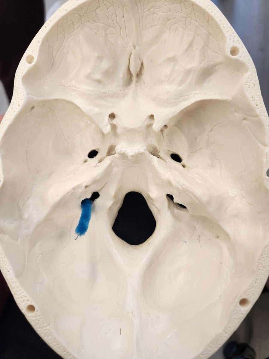 <p>What is this opening?</p><p>And what structures pass through this?</p>