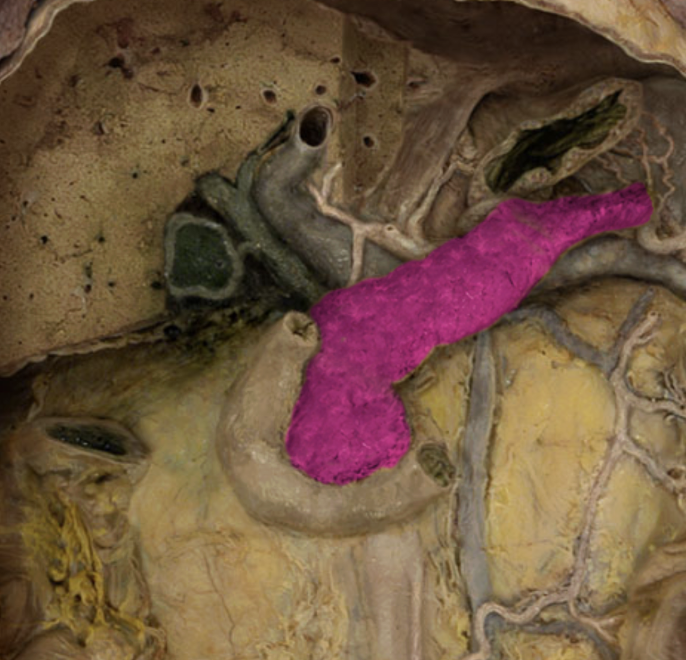 <p>Pancreas</p>