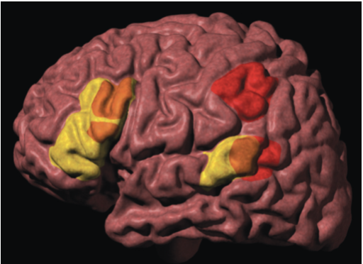 <p>What is so special about the brown areas in this image?</p>