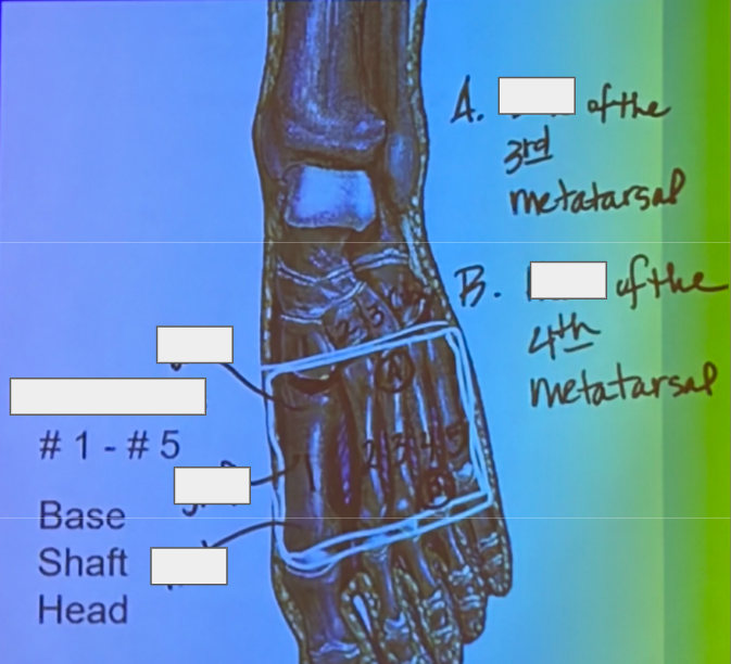 <p>Category: <span style="background-color: transparent;">__________________</span></p><ul><li><p><span>Type of Joint: ______________</span></p></li></ul><ul><li><p><span>Bones Involved: ____________________</span></p></li><li><p><span>Movement: _______________________</span></p></li><li><p><span>Function: ______________________</span></p></li></ul><p></p>