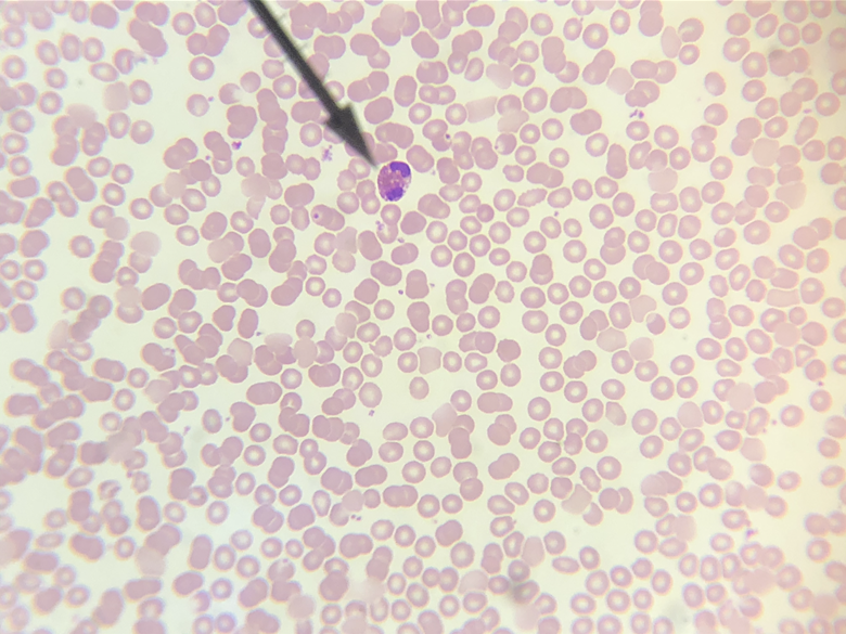 <p>In the image above, identify the formed element at the tip of the pointer.</p>