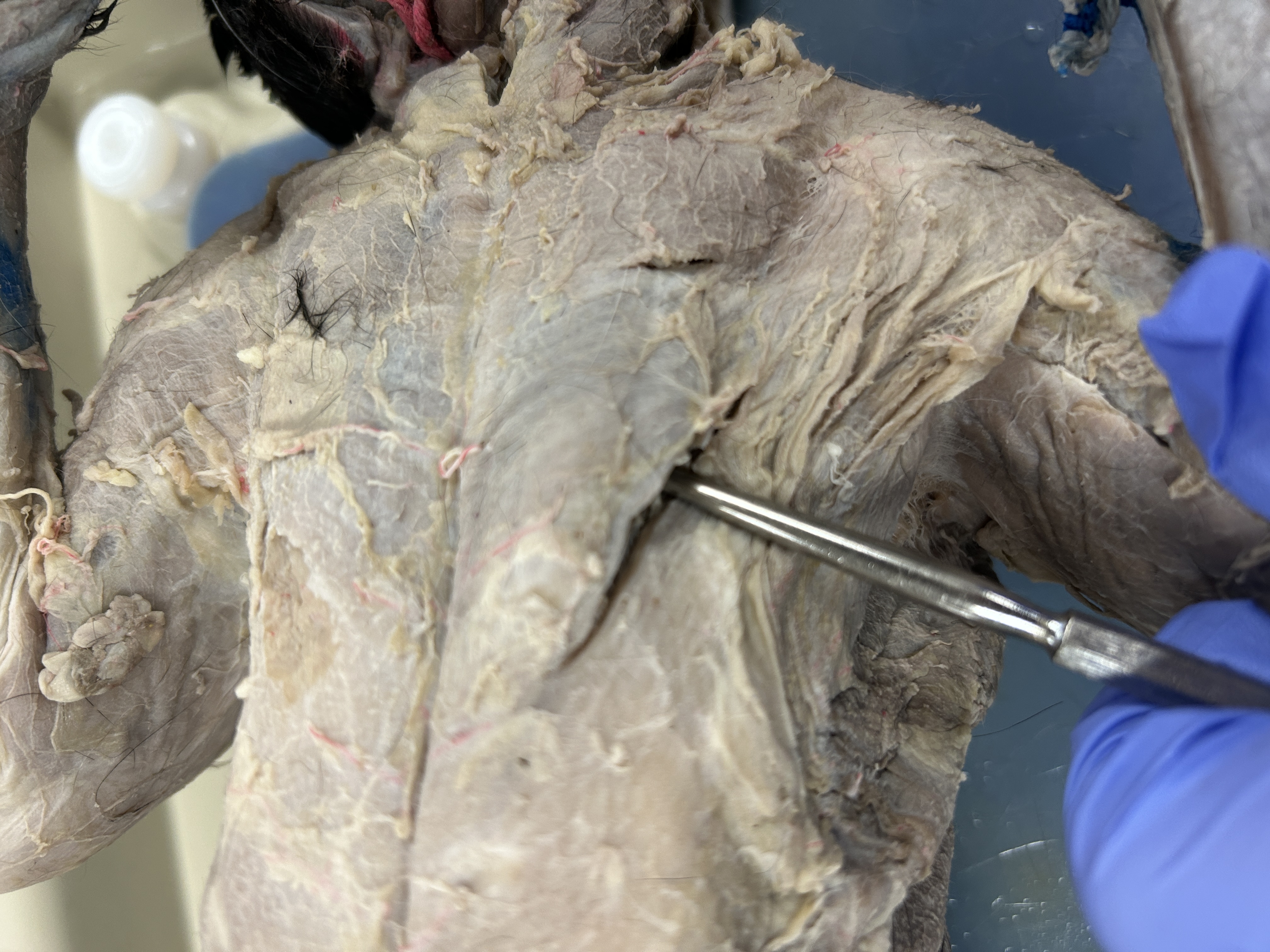 <p>Pectoralis Major</p>