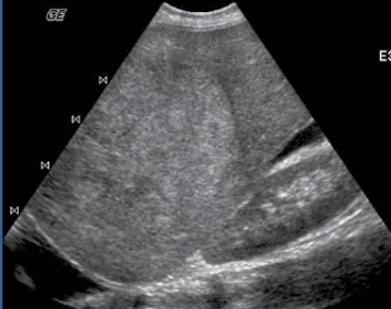 <p>what is being shown in this and its sonography</p>