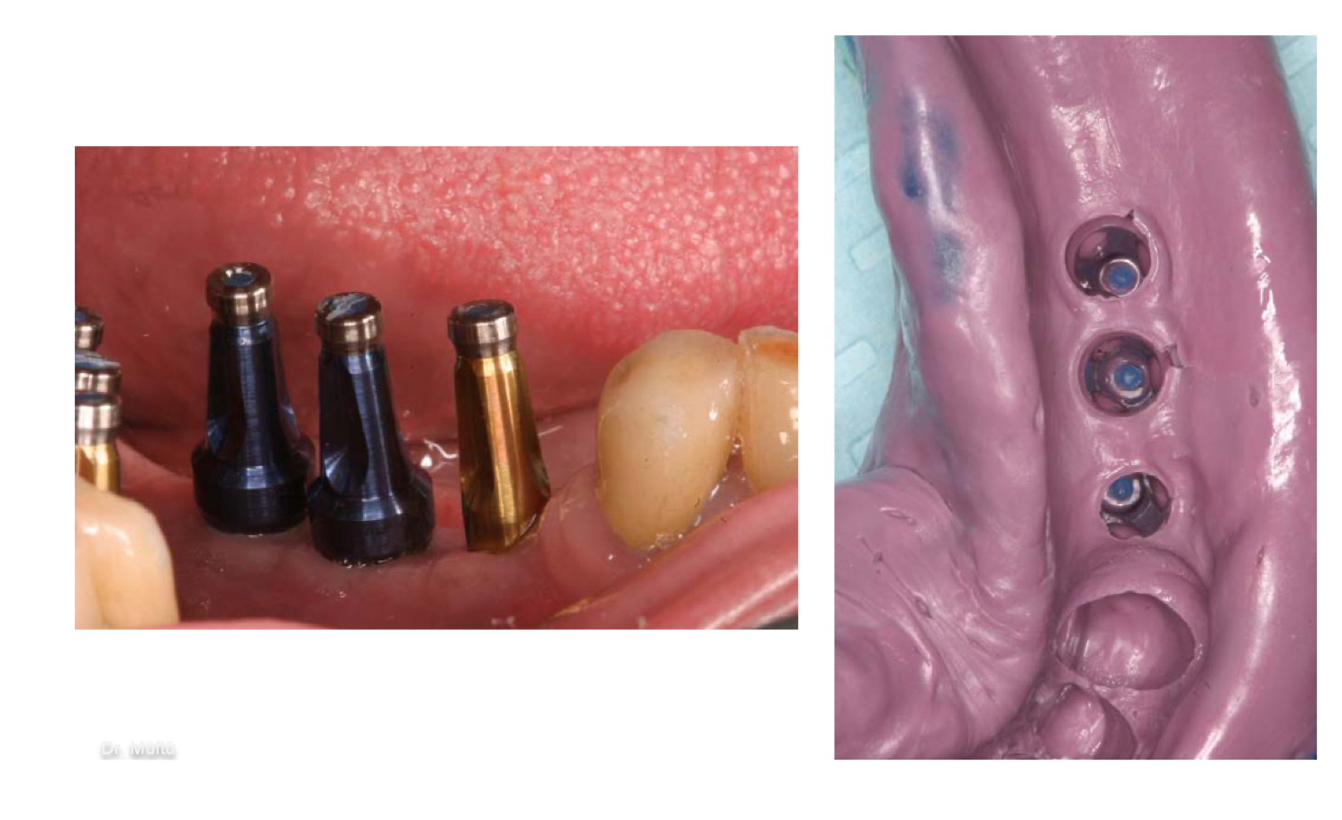 <p>how do we know this is the closed-tray technique?</p>