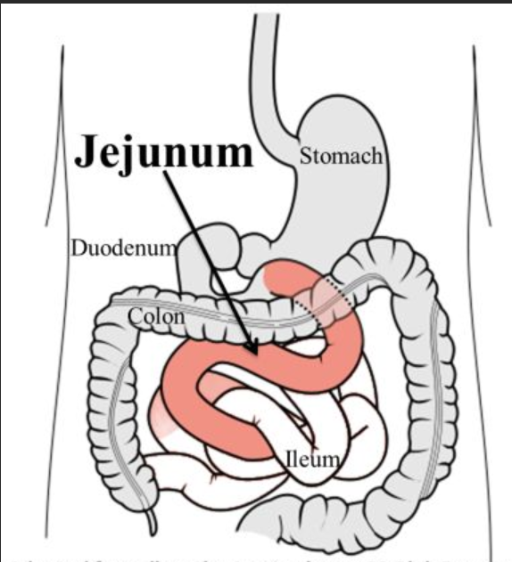 <p>there wasn’t a pic on APR, just know it’ll be after the duodenum and won’t be tagged closer to the cecum </p>