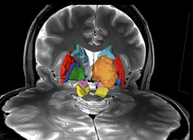 <p>What is the pink and yellow section in this image?</p>