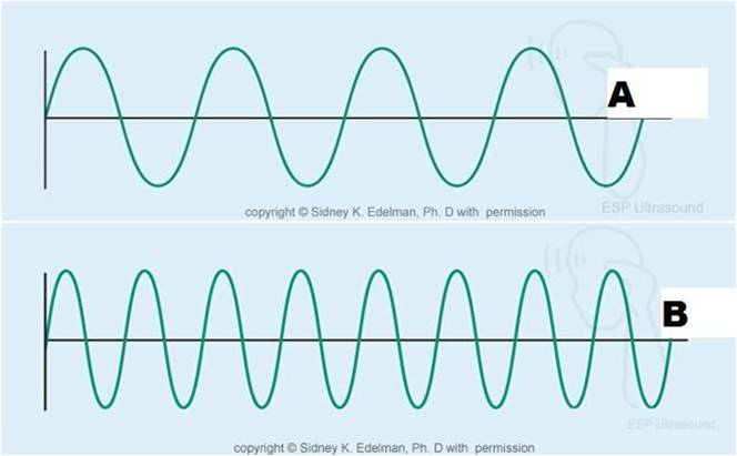 <p><strong>Which statement about the two pulse trains displayed are true?</strong></p><p>A has a higher frequency that B</p><p>B has a shorter period than A</p><p>A has a shorter wavelength than B</p><p>A has better axial resolution than B</p>