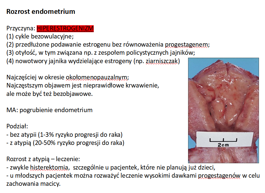 <p>E. Atypowy rozrost gruczołowy endometrium</p>