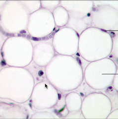 <p>closely packed adipocytes; acts as storage depots for fat with little cellular matrix</p><p>- rapid storage and mobilization of lipid molecules</p><p>- cushion and protection</p><p>- found cushioning around the kidneys and cushioning the back of the eye</p>