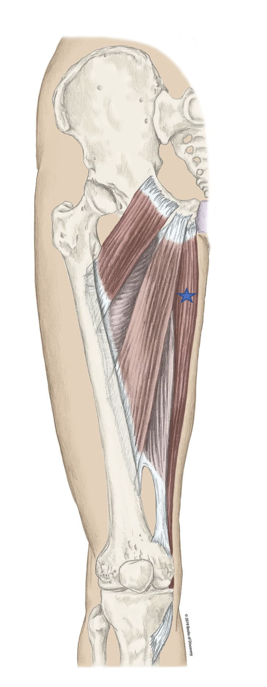 <p><span>From the list of muscles and actions below, identify the "starred" muscle and its primary actions.</span></p>