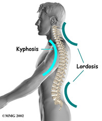 <p>-Kyphotic = curves posteriorly</p><p>-Lordotic= curves anteriorly</p>