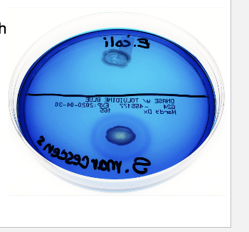 <p><span>Example negative bacteria in DNase test?</span></p>