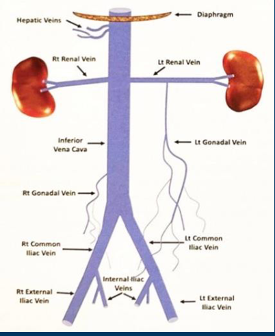 <p>Just a Picture to view </p>