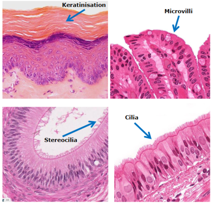<p><span style="color: red;"><strong>Keratinisation (skin surface):</strong></span></p><p>Location: Epidermis of the skin, especially thick on palms and soles</p><p>Structure: surface cells become filled with keratin (tough protein), where cells eventually die and form a protective outer layer</p><p>Function: Protection against abrasion, waterproofing, reduce water loss, barrier against pathogens</p><p><span style="color: red;"><strong>Microvilli (brush border in gut):</strong></span></p><p>Location: Small intestines, kidney tubules</p><p>Structure: Tiny finger-like projections of cell membrane, contain actin filaments, form a brush border.</p><p>Function: greatly increase surface area, increase absorption of nutrients</p><p><span style="color: red;"><strong>Cilia (respiratory tract):</strong></span></p><p>Location: Trachea, Bronchi, Larger airways</p><p>Structure: Hair-like motile projections, beat in coordinated fashion</p><p>Function: Move mucus and trapped particles towards the throat, so lungs are clean</p><p><span style="color: red;"><strong>Stereocilia (epididymis):</strong></span></p><p>Location: Epididymis (attached to the back of the testis), part of inner ear</p><p>Structure: Very long microvilli, not motile</p><p>Function: Increase surface area for absorption</p>