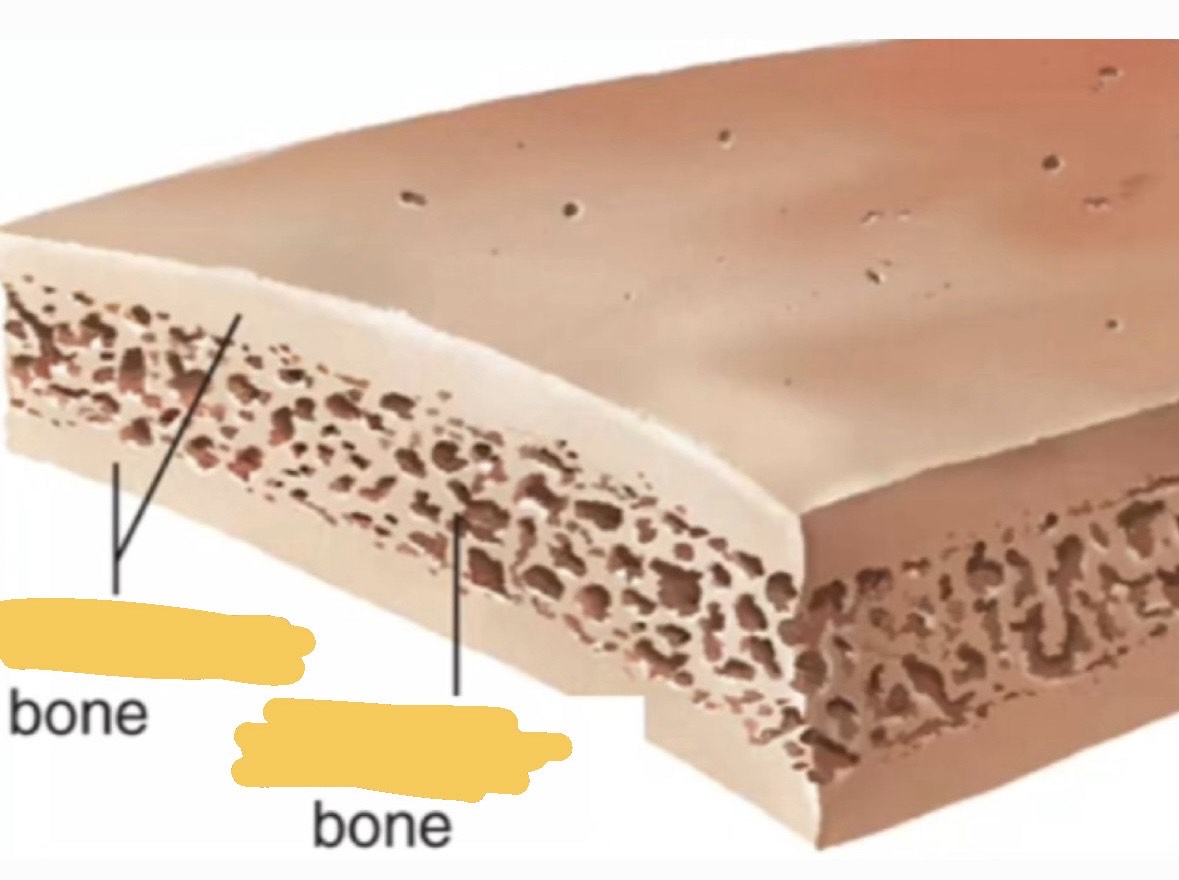 <p>What is this structure as a whole? Long or flat bone?</p>
