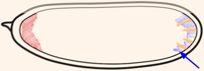 <p>Which cytoplasmic determinant is shown in the figure?</p>