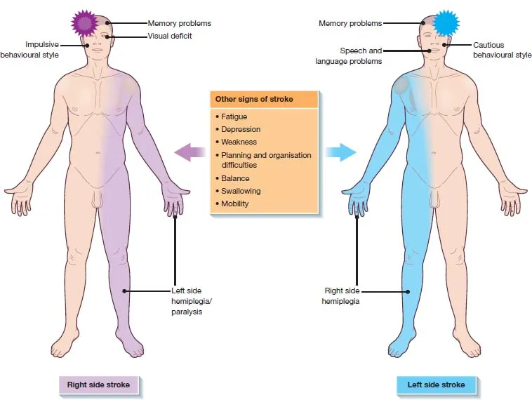 <p>Strokes affect one side of the brain, so the weakness on body will occur on _____ side of brain.</p>