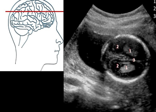 <p>Label the Superior Intracranial Anatomy</p>