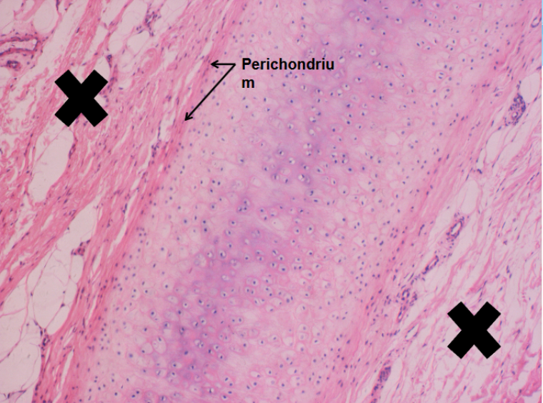 <p>Elastic cartilage</p>