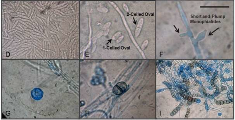 <p>Identify this fungus</p>