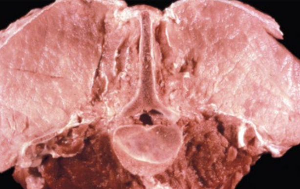 <p>Cross section of skeletal muscle from a pig. What is this pig showing? What is a potential cause?</p>