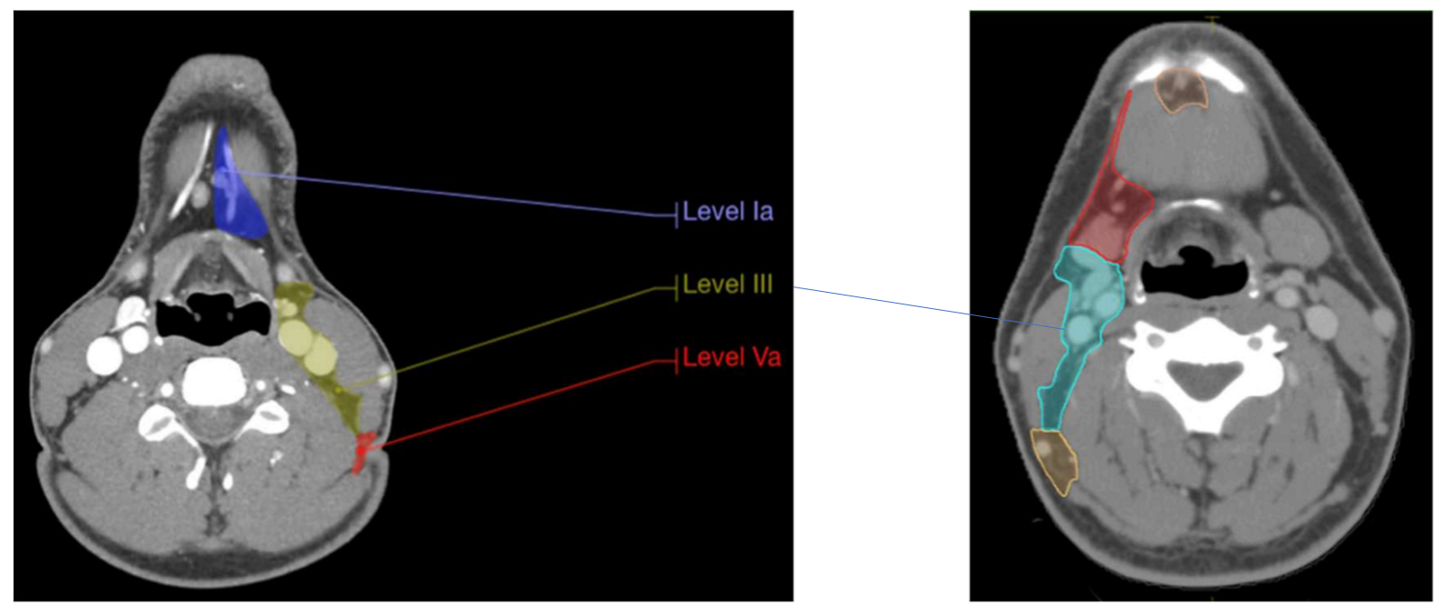 <p>what is the sup and inf border of level III - middle jugular group</p>