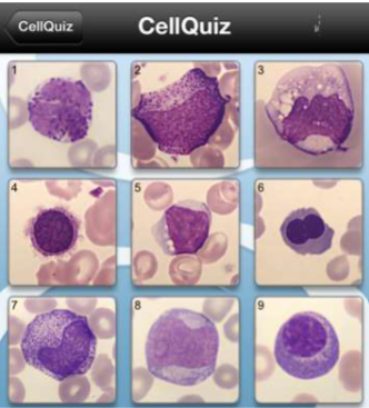 <p>Select the nRBC </p>