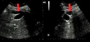 <p>Which of the following statements is true regarding the image displayed?</p>