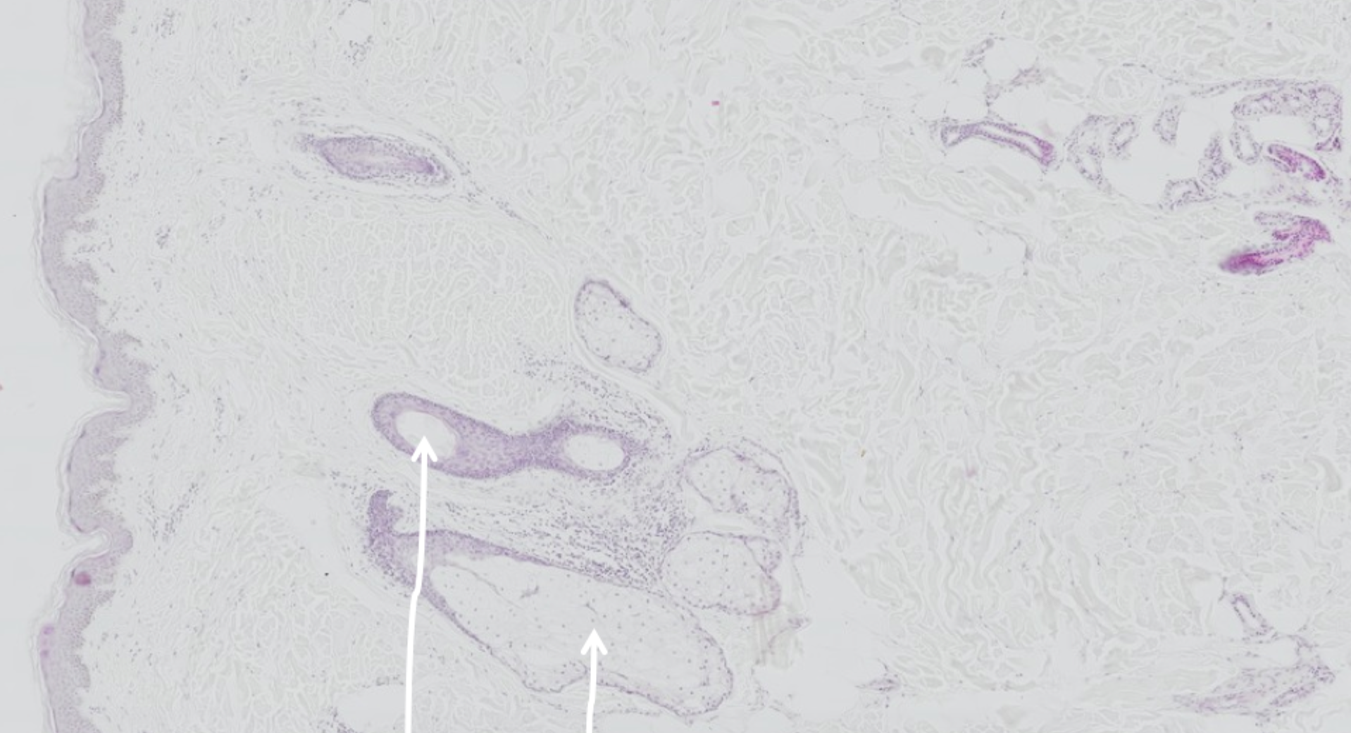 <p>Peg på epidermis og dermis (præp 64: tynd hud)</p>