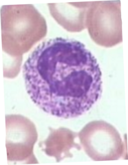<p>observed in bacterial infection where granules are darker in the neutrophils</p><p>seen in vacuolization and Dohle bodies</p>