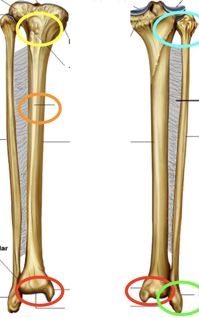 <p>What is the structure circled in yellow?</p>