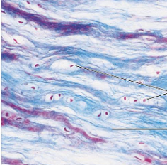 <p>what kind of tissue is this (cartilage)</p>