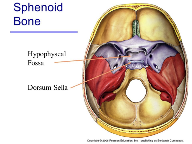 <ul><li><p>The hypophyseal fossa is a crucial structure for the diagnosis and treatment of pituitary disorders.</p></li><li><p>Abnormalities of the pituitary gland, such as tumors or cysts, can be detected through imaging techniques such as magnetic resonance imaging (MRI) or computed tomography (CT) scans of the hypophyseal fossa.</p></li><li><p>These imaging techniques can also guide the surgical removal of pituitary tumors, which can cause hormonal imbalances and other health problems (common in ages 10-12).</p></li></ul><p></p>