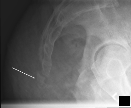 <p>what pathology is this?</p>