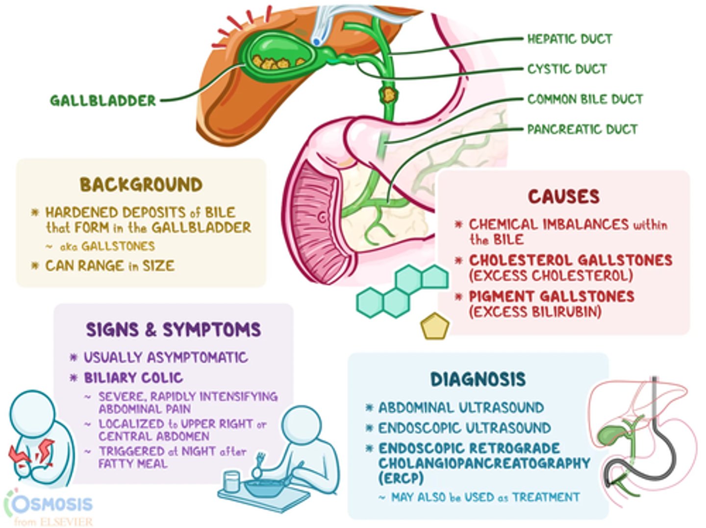 <p>B) Low grade fever, upper quadrant/RUQ pain ~30 minutes after eating a fatty meal, malaise, steatorrhea, pale stool indicating obstruction</p>