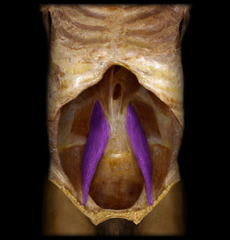 <p>identify the structure</p>