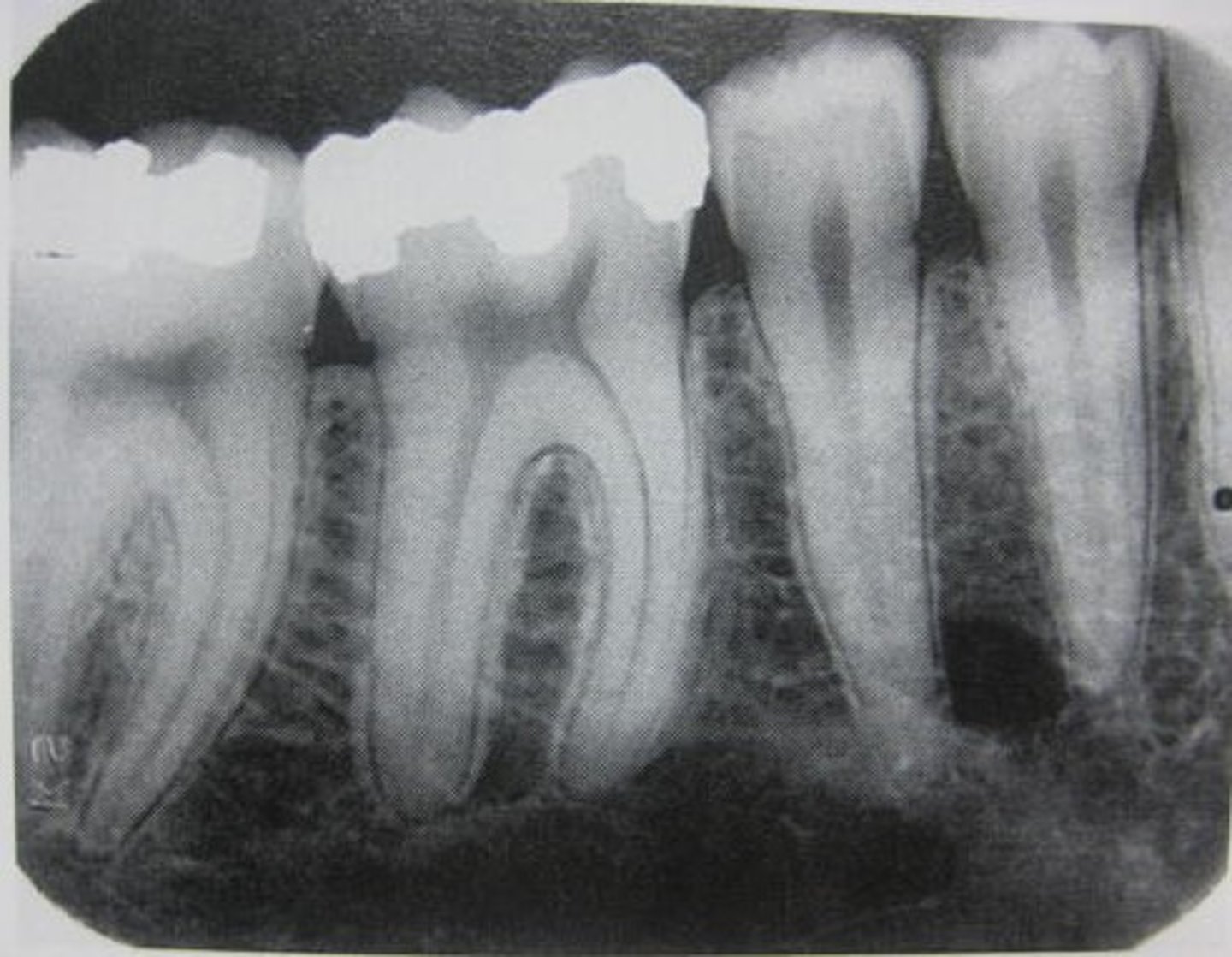 <p>any abnormalities of the root structure & surrounding bone structure</p>