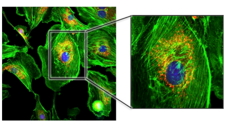 <p>fluorescence microscope + 3D imaging</p><p>high-resolution, 3D, multiple cell layers, light = laser light</p><p>layer scans 1 thin layer at a time —> computer stacks images together —> 3D image</p><ul><li><p>GREAT resolution + contrast</p></li><li><p>3D</p><ul><li><p>individual organelles visible</p></li></ul></li></ul><p></p>