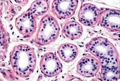 <p>Epithelial tissue. Tightly packed cells. One layer of cube shaped cells. Cells are found around the white circular areas.</p>