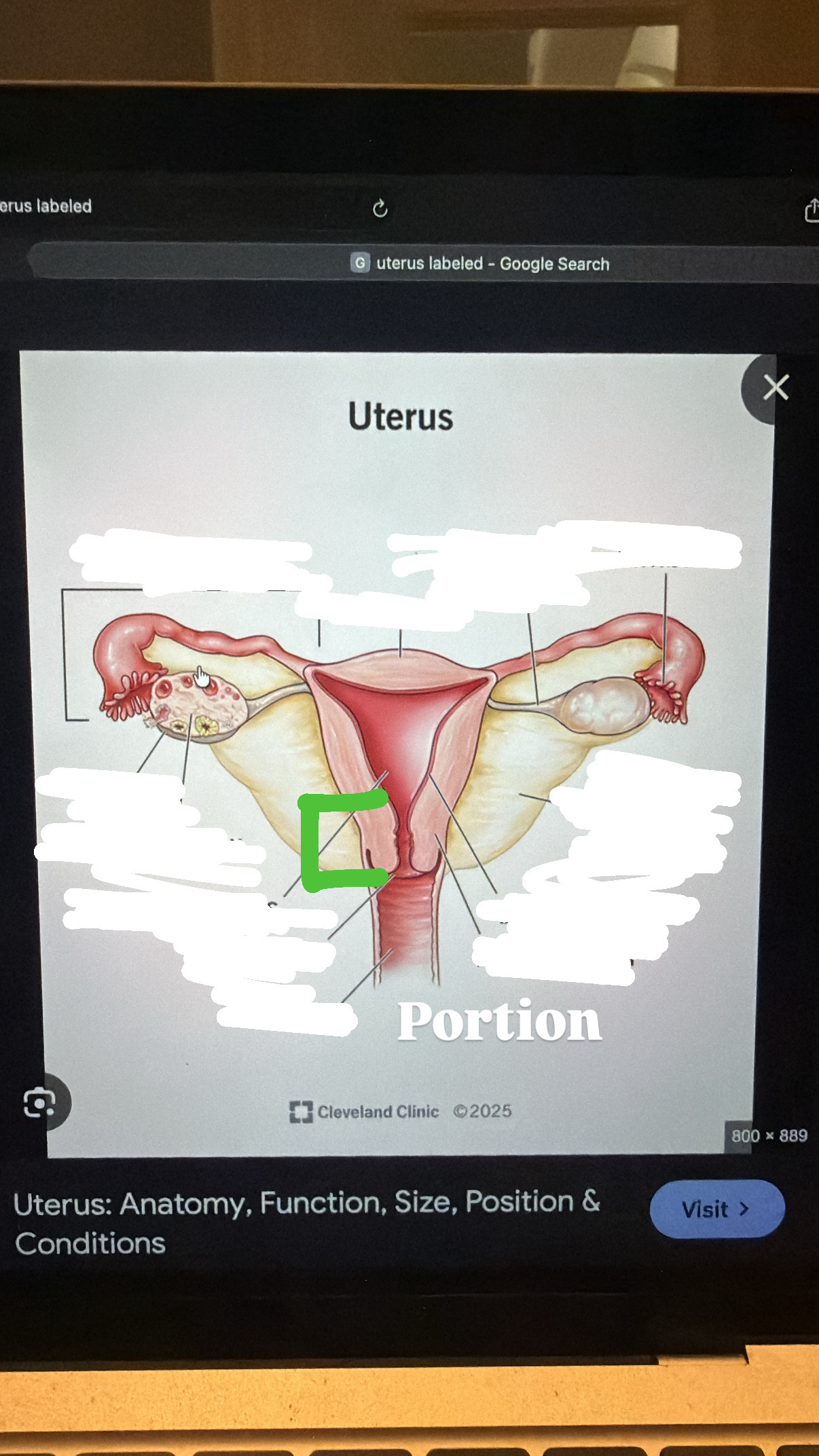 <p>section of uterus, where it narrows</p>
