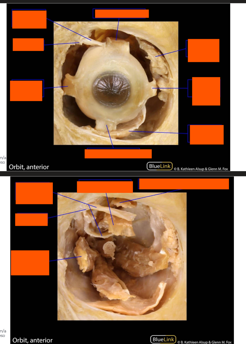 <p>Label this prossection</p>