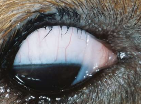 <p>What condition refers to lashes arising from the meibomian gland openings on the lid margin? This can be insignificant, but can also cause irritation and is treated with epilation, cryotherapy, lid splitting, or electrolysis. Recurrence is common.</p>