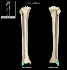 <p>bony prominence on the lateral side of the fibula (forms ankle)</p>