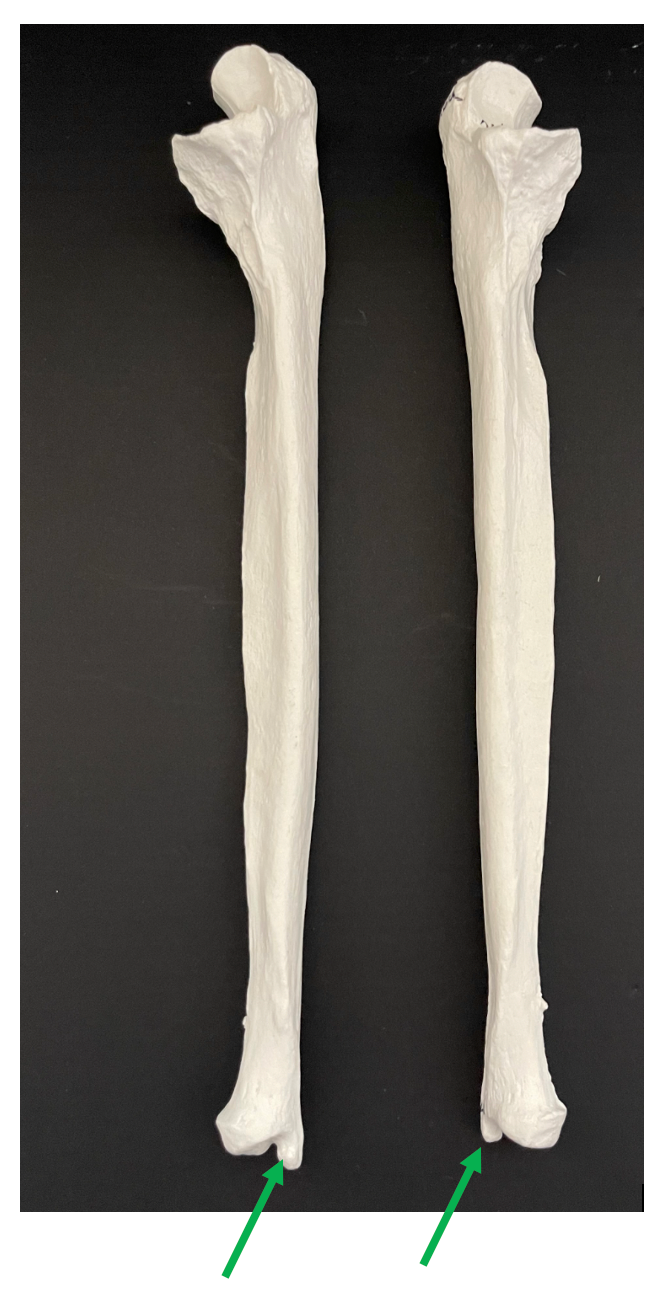 <p>Identify the bony landmark of the ulna that the arrow is pointing to.</p>