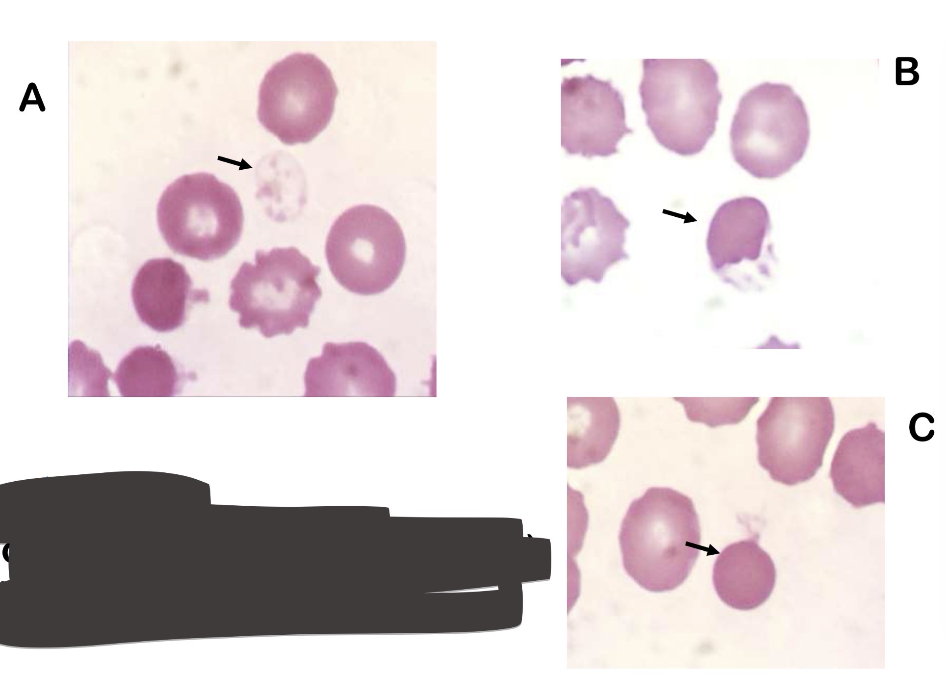 <p>Name these 3 RBCs</p>