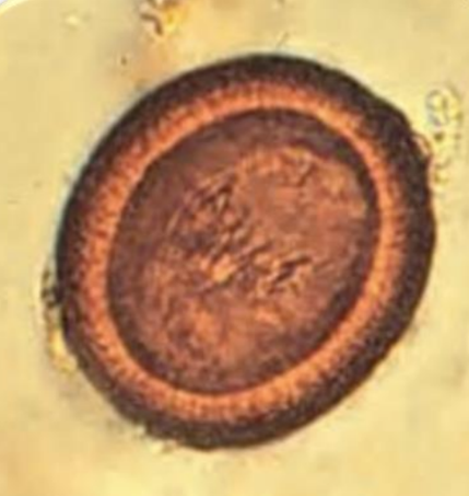 <ul><li><p><strong><em><u>diagnostic but DO NOT SPECIATE </u></em></strong></p></li><li><p>spherical</p></li><li><p>walnut - brown</p></li><li><p>smooth thick shell w <strong><em><u>RADIAL STRIATIONS</u></em></strong></p></li><li><p>6-hooked oncosphere may not be visible</p></li></ul><p></p>