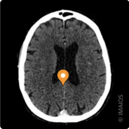 <p>Name the gyrus, modality, and the plane</p>