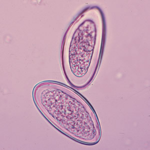 <p>Almond shaped egg? Anal itching at night?</p>